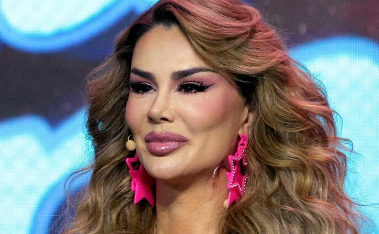 Ninel Conde sorprende tras múltiples cirugías y cambio de color de ojos